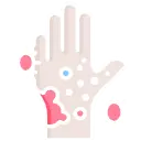 allergy